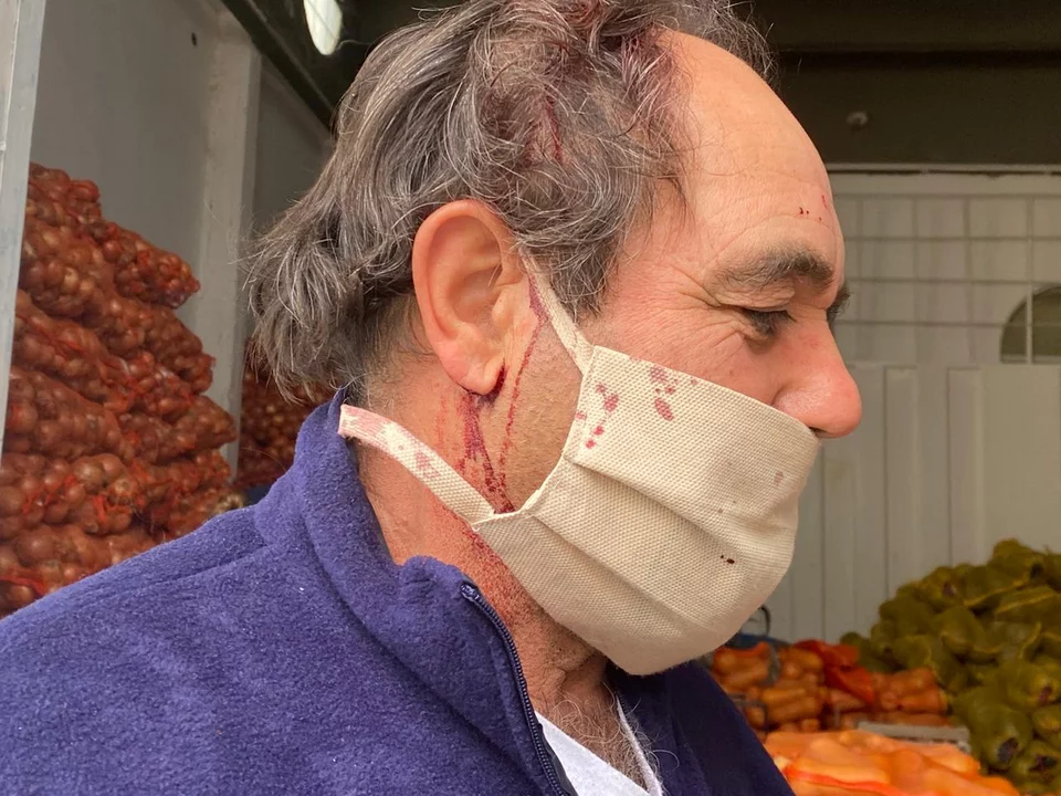 Dos hombres encapuchados y armados golpearon a un verdulero de Comodoro y se defendió a “fierrazos”. Foto: ADNSUR