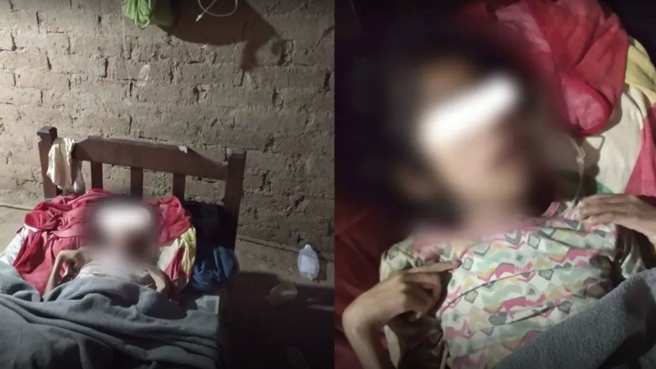 Pobreza extrema: tiene 12 años, quedó ciega y los chanchos le comieron  algunos dedos - ADNSUR - La niña iba a la escuela y jugaba como cualquier  niño de su edad, pero