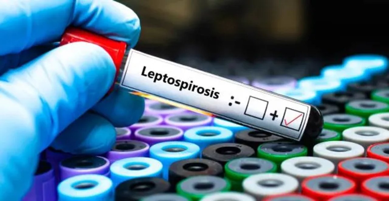 Investigación de casos sospechosos de leptospirosis en Bariloche