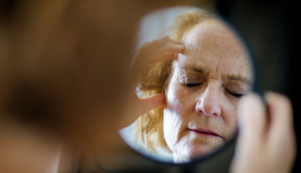 La migraña y su relación con las hormonas en mujeres
