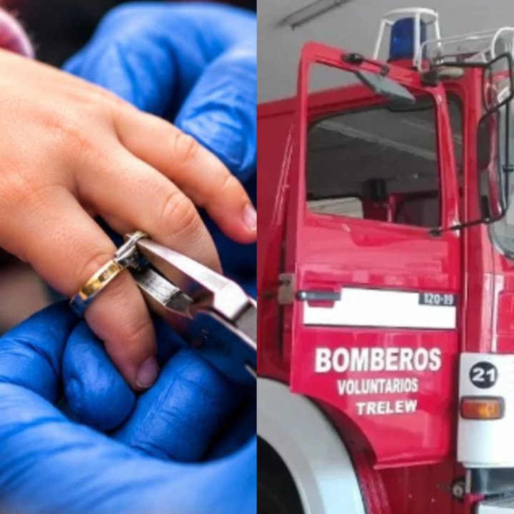 Bomberos asistieron a una niña de 4 años con un anillo atrapado en el dedo